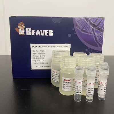 OEM Beaver Beads Nucleic Acid Kit Untuk Pengujian Air Limbah Penerbangan