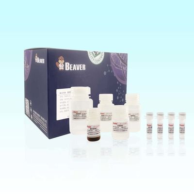 Kit Ekstraksi RNA Darah BeaverBeads Dengan Kompatibilitas Tinggi