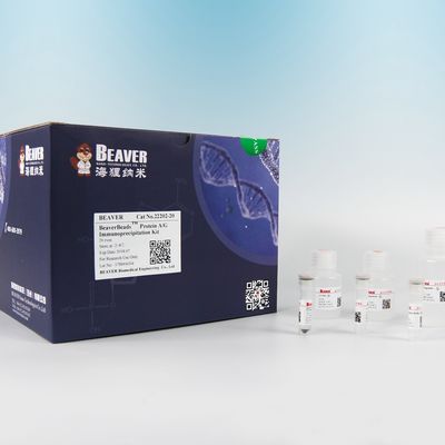 22203 Kit Imunopresipitasi Protein A/G Dengan Pengoperasian Sederhana yang Fleksibel