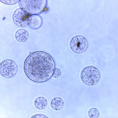 Pemurnian Protein Manik-manik Magnetik 150 μm Rasio Volume 10% 5 mL
